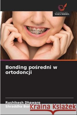 Bonding posredni w ortodoncji Dhaware, Rushikesh, Borse, Shraddha 9786209392887 Wydawnictwo Nasza Wiedza - książka