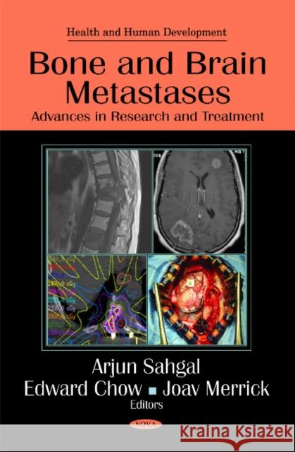 Bone & Brain Metastases: Advances in Research & Treatment Arjun Sahgal, Edward Chow, Joav Merrick, MD, MMedSci, DMSc 9781616683658 Nova Science Publishers Inc - książka