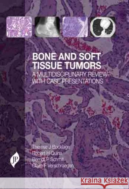 Bone and Soft Tissue Tumors : A Multidisciplinary Review with Case Presentations Therese J. Bocklage Robert Quinn Berndt Schmit 9781907816222 JP Medical Ltd - książka