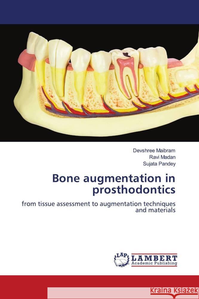 Bone augmentation in prosthodontics Maibram, Devshree, Madan, Ravi, Pandey, Sujata 9786205515853 LAP Lambert Academic Publishing - książka
