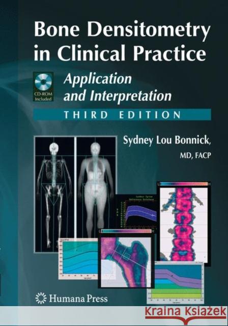 Bone Densitometry in Clinical Practice: Application and Interpretation Bonnick, Sydney Lou 9781493960910 Humana Press - książka