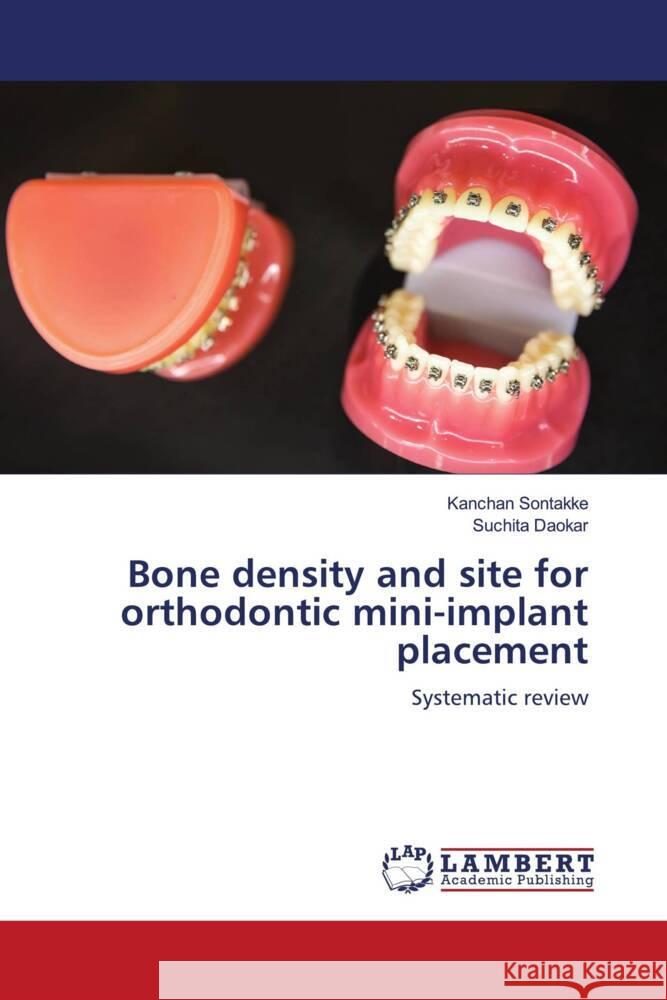 Bone density and site for orthodontic mini-implant placement Sontakke, Kanchan, Daokar, Suchita 9786204747880 LAP Lambert Academic Publishing - książka