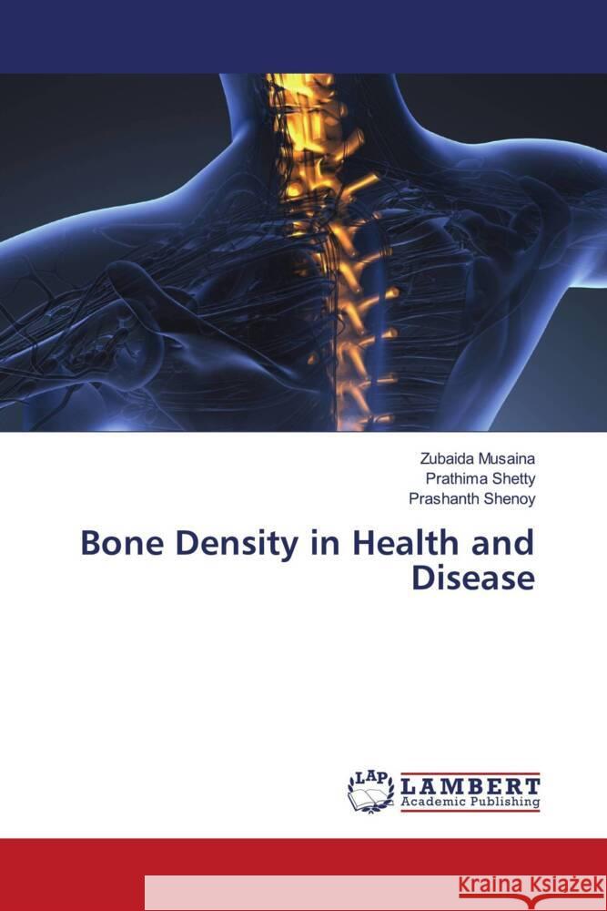 Bone Density in Health and Disease Zubaida Musaina Prathima Shetty Prashanth Shenoy 9786205631621 LAP Lambert Academic Publishing - książka