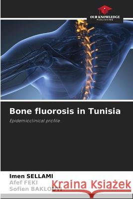 Bone fluorosis in Tunisia Imen Sellami Afef Feki Sofien Baklouti 9786207547043 Our Knowledge Publishing - książka