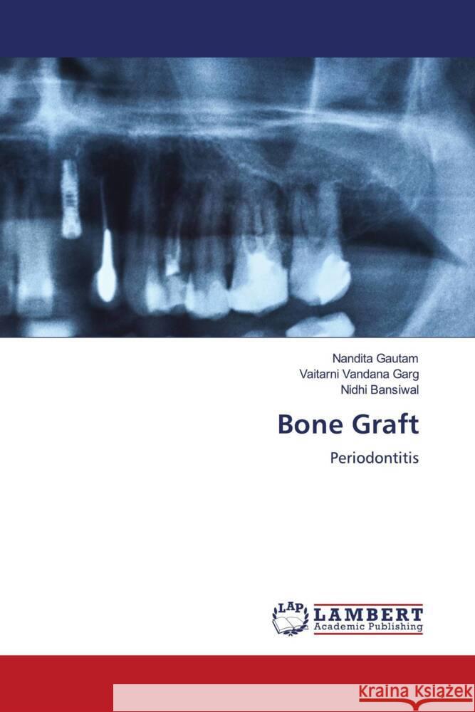 Bone Graft Gautam, Nandita, Garg, Vaitarni Vandana, Bansiwal, Nidhi 9786204984544 LAP Lambert Academic Publishing - książka