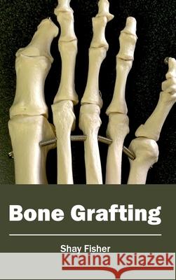 Bone Grafting Shay Fisher 9781632410603 Hayle Medical - książka