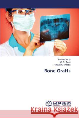 Bone Grafts Ahuja Lochan                             Baiju C. S.                              Khashu Himanshu 9783659386664 LAP Lambert Academic Publishing - książka