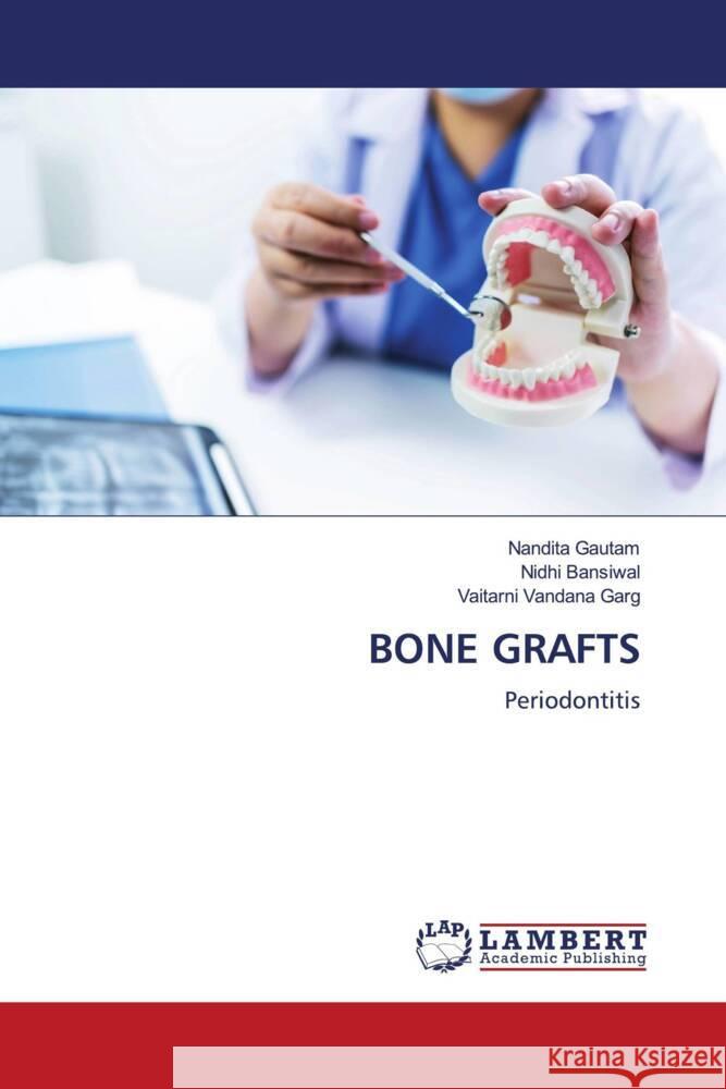 BONE GRAFTS Gautam, Nandita, Bansiwal, Nidhi, Garg, Vaitarni Vandana 9786204984292 LAP Lambert Academic Publishing - książka