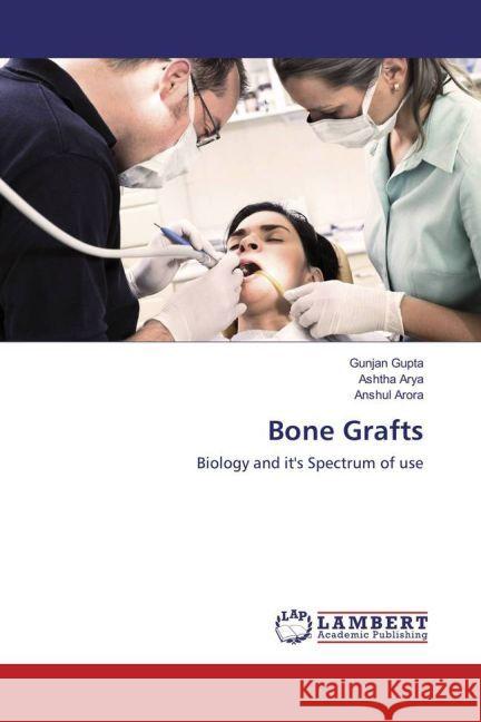 Bone Grafts : Biology and it's Spectrum of use Gupta, Gunjan; Arya, Ashtha; Arora, Anshul 9783659925979 LAP Lambert Academic Publishing - książka