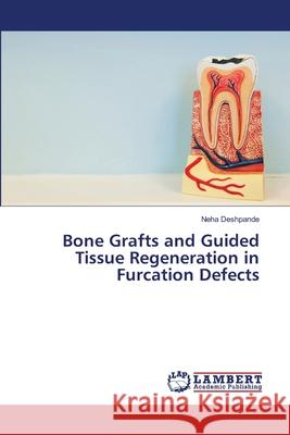 Bone Grafts and Guided Tissue Regeneration in Furcation Defects Deshpande, Neha 9786205493427 LAP Lambert Academic Publishing - książka