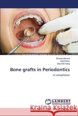 Bone grafts in Periodontics Shweta Bansal, Harjit Kaur, Saurabh Garg 9783659204890 LAP Lambert Academic Publishing - książka