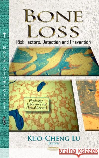 Bone Loss: Risk Factors, Detection & Prevention Kuo-Cheng Lu 9781624171697 Nova Science Publishers Inc - książka