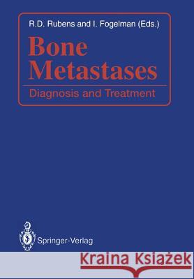 Bone Metastases: Diagnosis and Treatment Rubens, Robert D. 9781447132561 Springer - książka