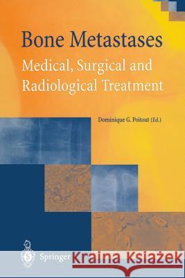 Bone Metastases: Medical, Surgical and Radiological Treatment Dominique G. Poitout 9781447132530 Springer - książka