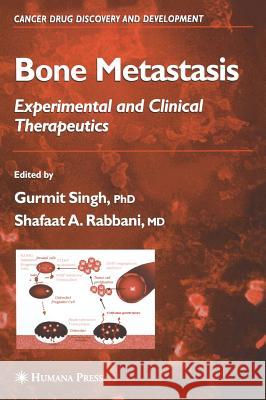 Bone Metastasis Gurmit Singh Gurmit Singh Shafaat A. Rabbani 9781588294036 Humana Press - książka