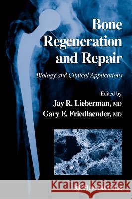 Bone Regeneration and Repair: Biology and Clinical Applications Lieberman, Jay R. 9780896038479 Humana Press - książka