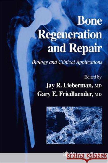 Bone Regeneration and Repair: Biology and Clinical Applications Lieberman, Jay R. 9781617372193 Springer - książka