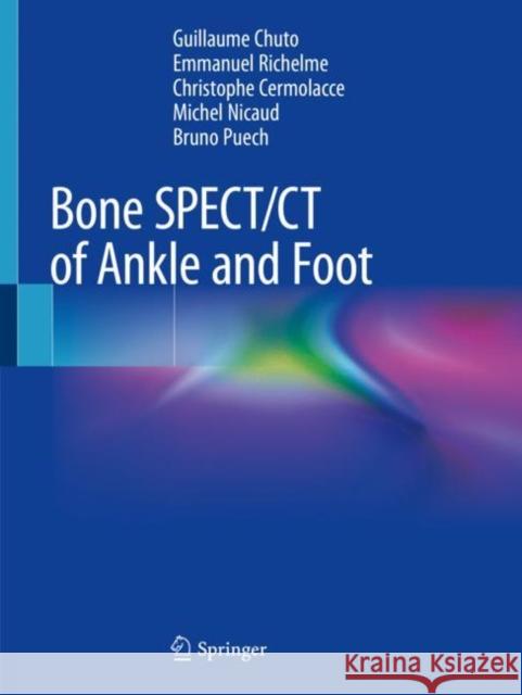 Bone Spect/CT of Ankle and Foot Chuto, Guillaume 9783319908106 Springer - książka