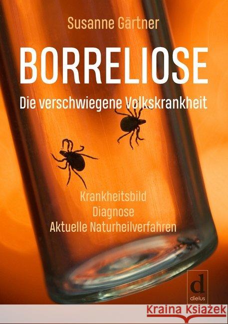 Borreliose - Die verschwiegene Volkskrankheit : Krankheitsbild. Diagnose. Aktuelle Naturheilverfahren Gärtner, Susanne 9783981892888 dielus edition - książka