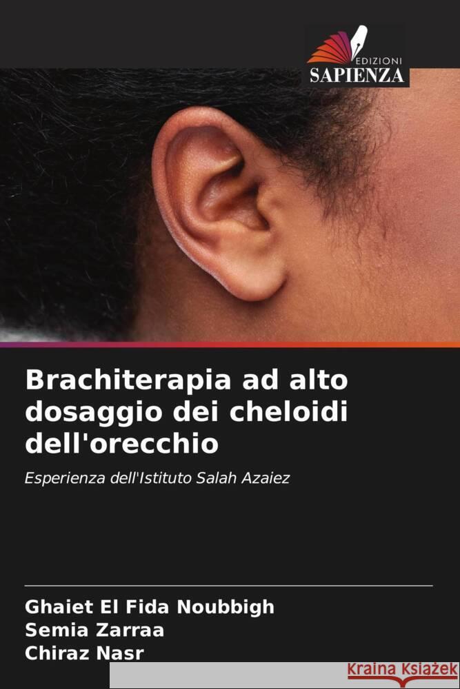 Brachiterapia ad alto dosaggio dei cheloidi dell'orecchio Noubbigh, Ghaiet El Fida, Zarraa, Semia, Nasr, Chiraz 9786205472415 Edizioni Sapienza - książka