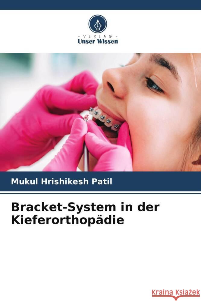 Bracket-System in der Kieferorthop?die Mukul Hrishikes 9786206919018 Verlag Unser Wissen - książka