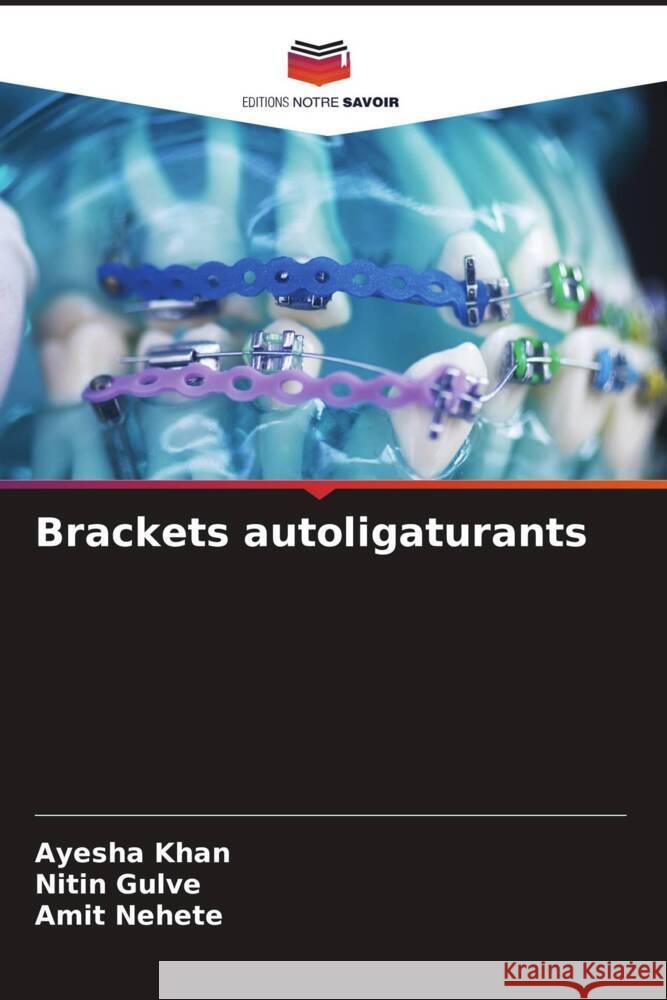 Brackets autoligaturants Khan, Ayesha, Gulve, Nitin, Nehete, Amit 9786204678474 Editions Notre Savoir - książka