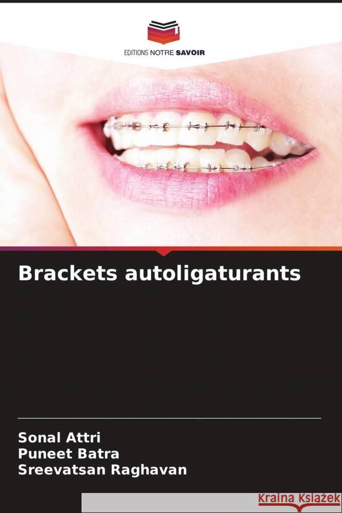 Brackets autoligaturants Sonal Attri Puneet Batra Sreevatsan Raghavan 9786206037408 Editions Notre Savoir - książka