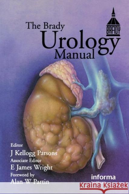 Brady Urology Manual J. Kellogg Parsons E. James Wright Alan W. Partin 9781841844817 Informa Healthcare - książka