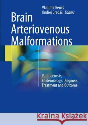 Brain Arteriovenous Malformations: Pathogenesis, Epidemiology, Diagnosis, Treatment and Outcome Benes, Vladimír 9783319639635 Springer - książka