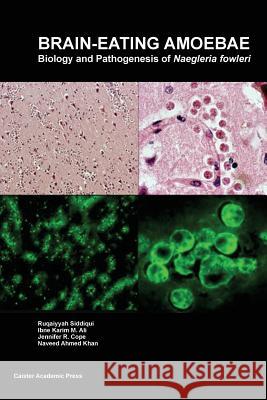 Brain-eating Amoebae: Biology and Pathogenesis of Naegleria fowleri Siddiqui, Ruqaiyyah 9781910190531 Caister Academic Press - książka