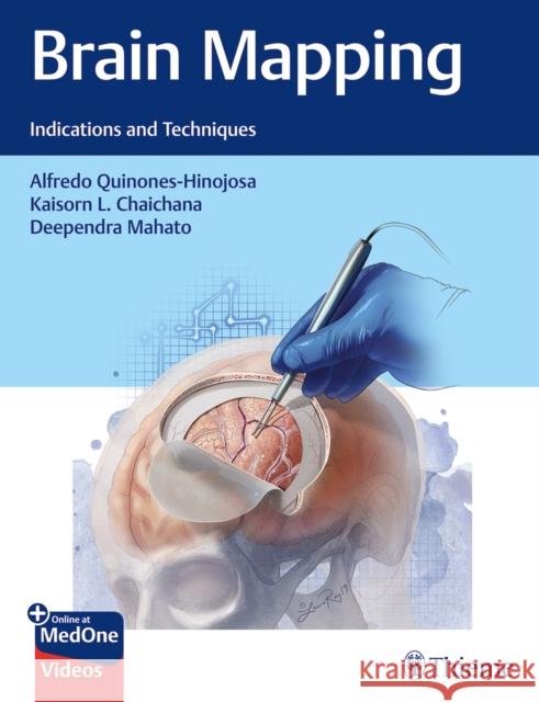 Brain Mapping: Indications and Techniques Quinones-Hinojosa, Alfredo 9781684200924 Thieme Medical Publishers - książka