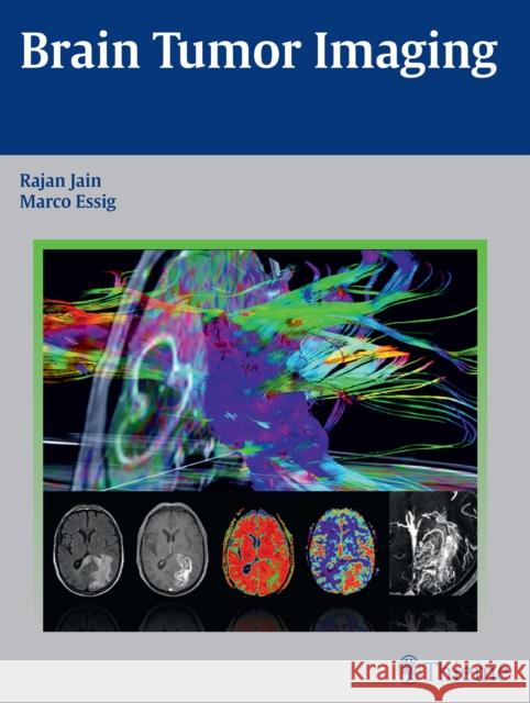 Brain Tumor Imaging Rajan Jain Marco Essig 9781604068061 Thieme Medical Publishers - książka