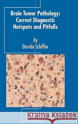 Brain Tumor Pathology: Current Diagnostic Hotspots and Pitfalls Davide Schiffer D. Schiffer 9781402039973 Springer - książka