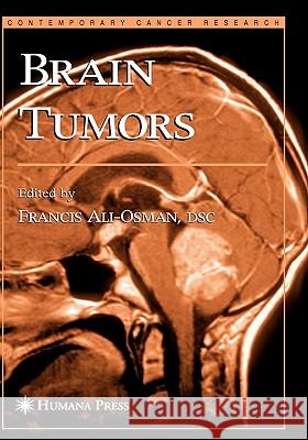 Brain Tumors Francis Ali-Osman 9781588290427 Humana Press - książka