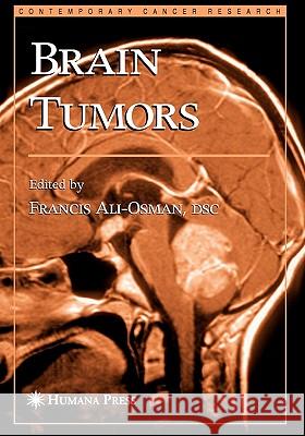 Brain Tumors Francis Ali-Osman 9781617373206 Springer - książka