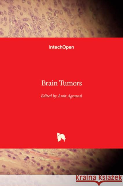 Brain Tumors Amit Agrawal   9781839698033 Intechopen - książka