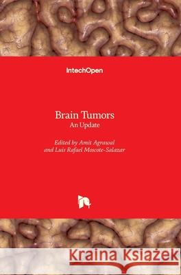 Brain Tumors: An Update Amit Agrawal Luis Rafael Moscote-Salazar 9781789235562 Intechopen - książka