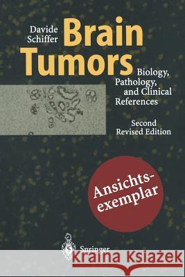 Brain Tumors: Biology, Pathology and Clinical References Schiffer, Davide 9783642644450 Springer - książka