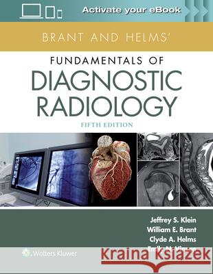 Brant and Helms' Fundamentals of Diagnostic Radiology Jeffrey Klein Jennifer Pohl Emily N. Vinson 9781496367389 Lippincott Williams and Wilkins - książka