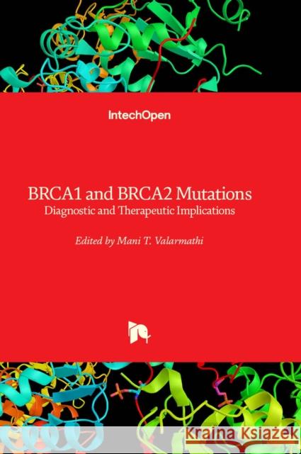 BRCA1 and BRCA2 Mutations: Diagnostic and Therapeutic Implications Mani T. Valarmathi 9781803568065 IntechOpen - książka