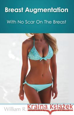 Breast Augmentation With No Scar On The Breast William R Burden 9780692887707 William Burden - książka