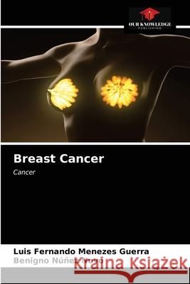Breast Cancer Luis Fernando Menezes Guerra Benigno N 9786203482225 Our Knowledge Publishing - książka