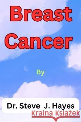 Breast Cancer Dr Steve J Hayes   9798399741833 Independently Published - książka