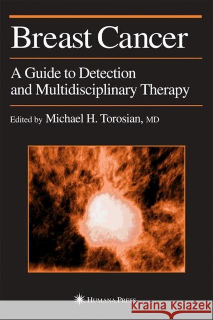 Breast Cancer: A Guide to Detection and Multidisciplinary Therapy Torosian, Michael H. 9780896038394 Humana Press - książka