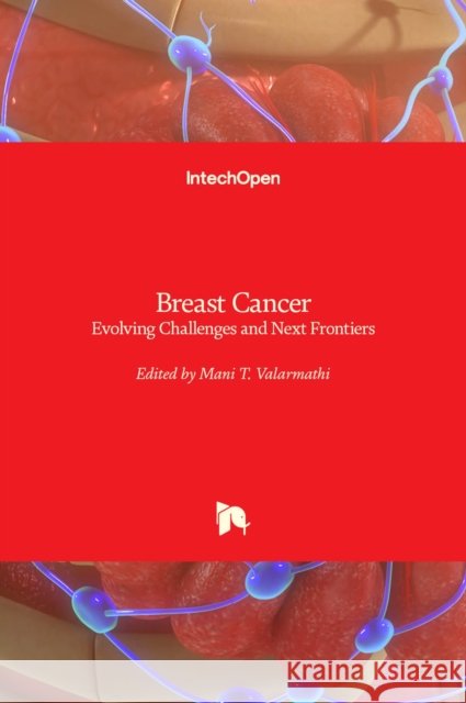 Breast Cancer: Evolving Challenges and Next Frontiers Mani T. Valarmathi 9781839692024 IntechOpen - książka