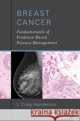 Breast Cancer: Fundamentals of Evidence-Based Disease Management I. Craig Henderson 9780199919987 Oxford University Press, USA - książka