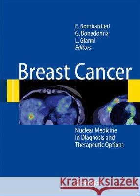 Breast Cancer: Nuclear Medicine in Diagnosis and Therapeutic Options Bombardieri, Emilio 9783540367802 Springer - książka