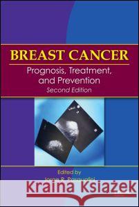 Breast Cancer: Prognosis, Treatment, and Prevention Jorge Pasqualini 9781420058727 Informa Healthcare - książka