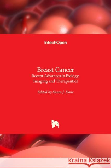 Breast Cancer: Recent Advances in Biology, Imaging and Therapeutics Susan Done 9789533077307 Intechopen - książka