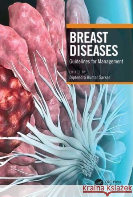 Breast Diseases  9780367609696 Taylor & Francis Ltd - książka